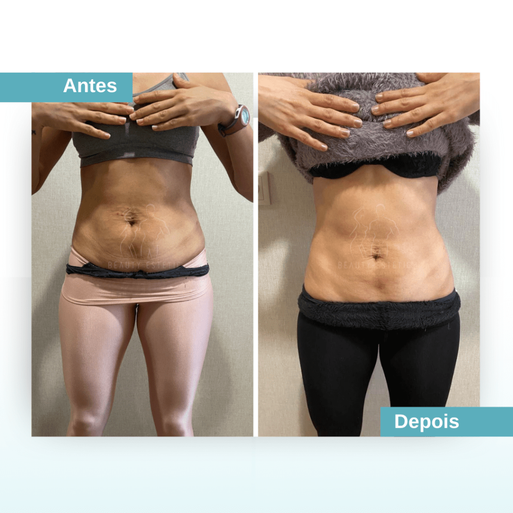 Abdominais definidos