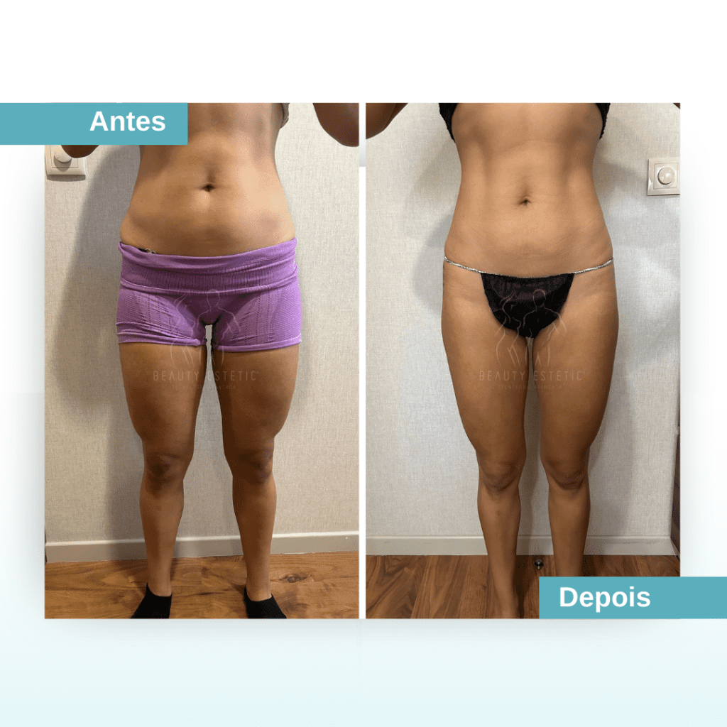 Abdominais definidos